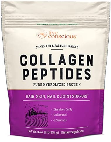 Collagen Peptides - Hair, Skin, Nail, and Joint Support - Type I & III Collagen - All-Natural Hydrolyzed Protein - 41 Servings - 16oz